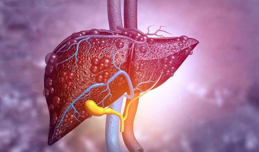 liver_20250926_175854795