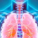 বাতাসে ছড়ায় যক্ষ্মার জীবাণু, ঝুঁকি কমাতে মেনে চলুন ৫ অভ্যাস